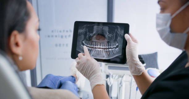 Licensed Dental Implants service in Lufkin, TX - Smile Center Dentistry